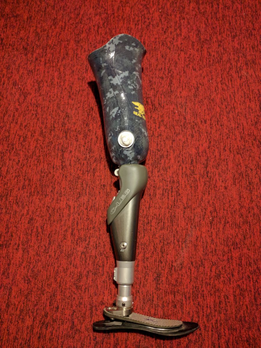 Prostheses South County Artificial Limb Rhode Island